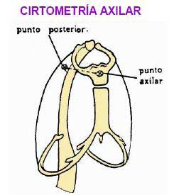 fisioterapia respiratoria