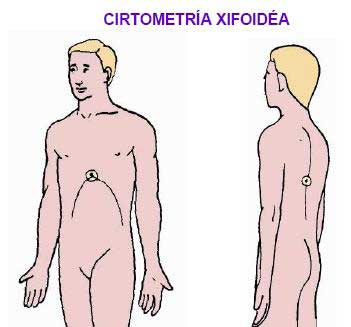 fisioterapia respiratoria