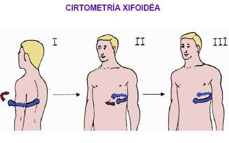 fisioterapia respiratoria