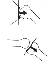 terapia manual ortopédica