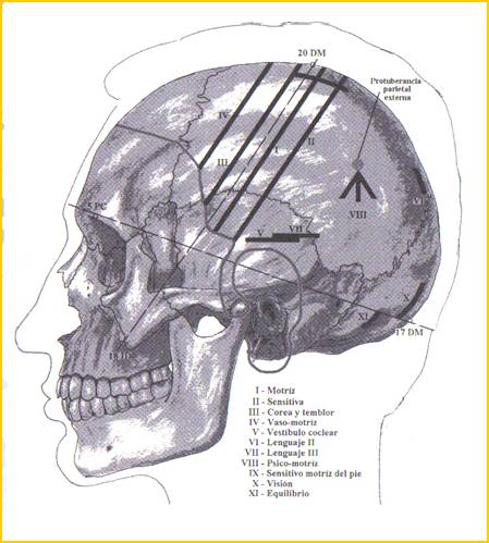 Tratamiento interdisciplinar de parkinson