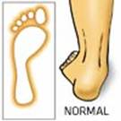 Fisioterapia de las patologías del pie