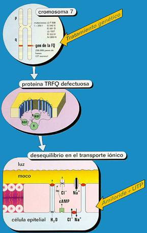 Fisioterapia respiratoria