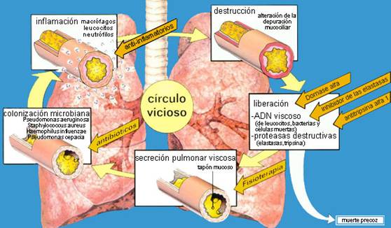 Fisioterapia respiratoria