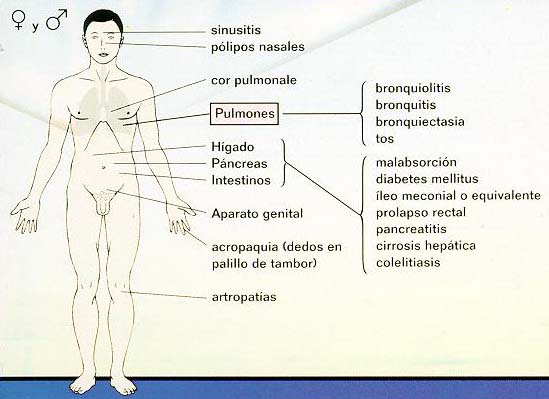 Fisioterapia respiratoria