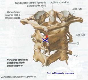 Test de seguridad cervical