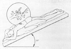 Fisioterapia respiratoria