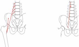 Osteopatía crónica de pubis