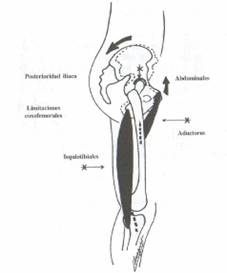 Osteopatía crónica de pubis