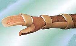 terapia osteoartritei deformante