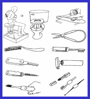 Fisioterapia en la artritis reumatoide