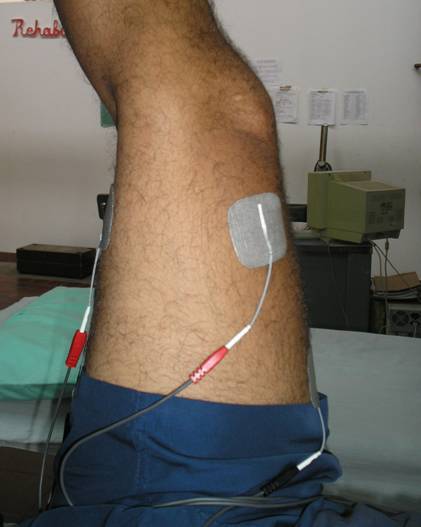 electroestimulación muscular