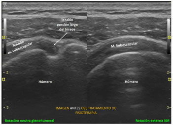 Ecografía musculoesquelética