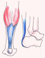 musculatura pierna posterior tendon aquiles