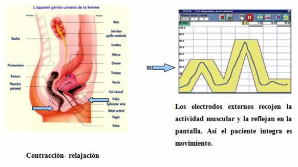 fisioterapia perineal en pediatría