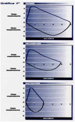 enfermedades respiratorias obstructivas