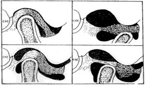 Terapia manual de la articulación temporomandibular