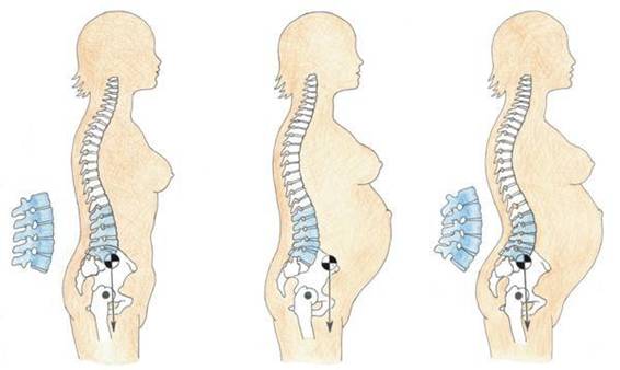 Terapia manual en el embarazo