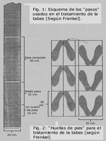 atrofia multisistémica