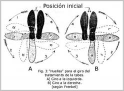 atrofia multisistémica