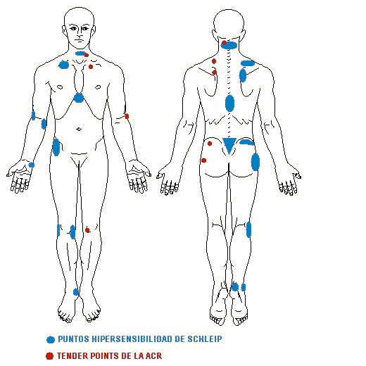 Análisis de los tender points