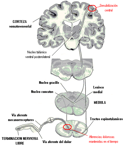 Sensibilización central