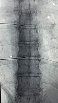 Percutor estructural