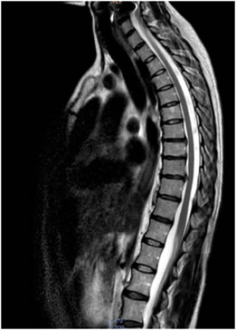 Percutor estructural