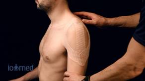 vendaje neuromuscular