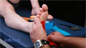 endaje Neuromuscular  calcaneo plantar