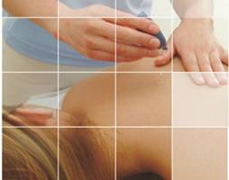 Fibromialgia