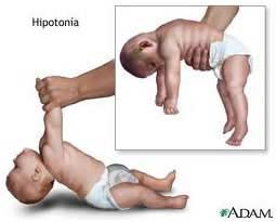Herramientas basicas para la evaluación neuromotriz en pediatría