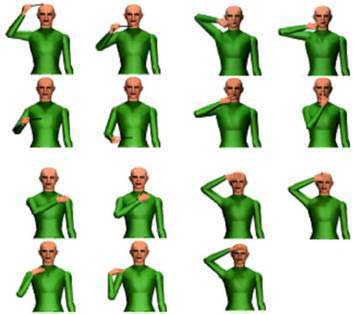 Tratamiento del hombro hemipléjico mediante biofeedback: a propósito de un caso clínico