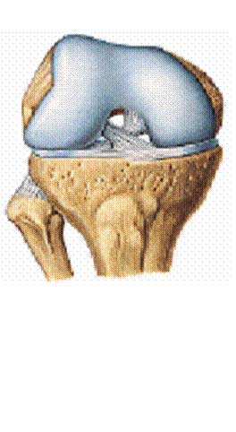 Tratamiento fisioterápico de la artrosis de rodilla