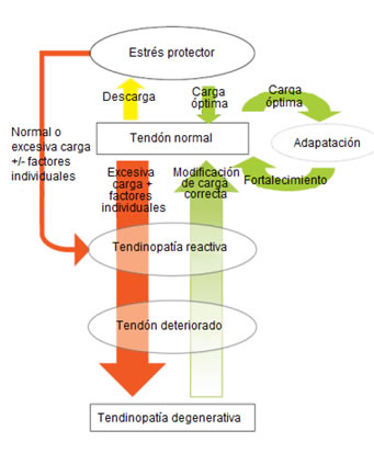 Ejercicios excéntricos en tendinopatía aquilea