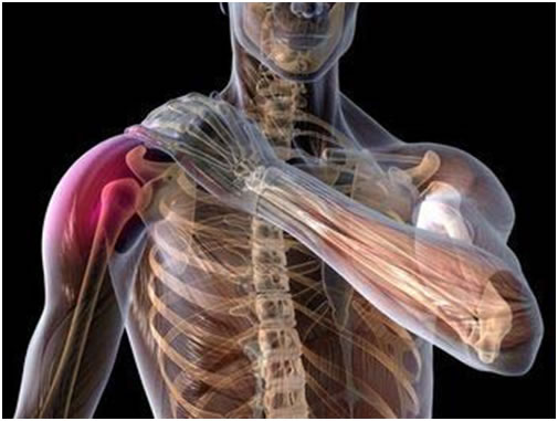 Caso clínico tratamiento basado en pilates Caso clínico tratamiento basado en pilates