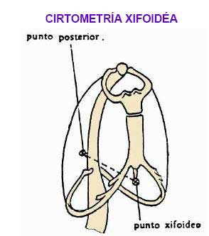 Tecnicas generales en fisioterapia respiratoria