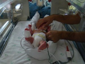 Dolor en los recién nacidos Dolor en los recién nacidos