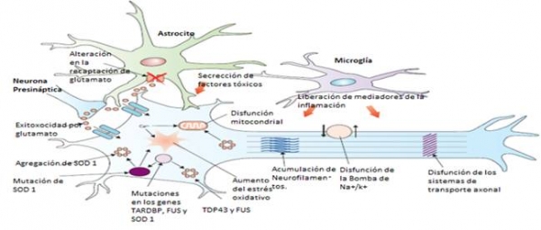 Evaluación neurofisiológica de la afectación de motoneurona superior y del tratamiento rehabilitador en la evolución de la esclerosis lateral amiotrófica