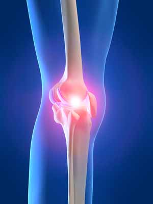 Puntos clave en la rehabilitación de rodilla