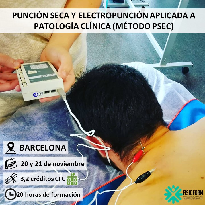 Curso Punción Seca y Electropunción aplicada a patología clínica (BARCELONA) Curso Punción Seca y Electropunción aplicada a patología clínica (BARCELONA)