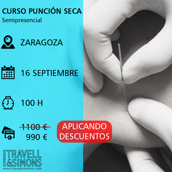 Fisioterapia conservadora e invasiva del síndrome de dolor miofascial (punción seca). TRAVELL Y SIMONS Zaragoza Fisioterapia conservadora e invasiva del síndrome de dolor miofascial (punción seca). TRAVELL Y SIMONS Zaragoza