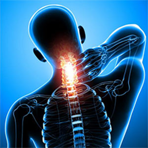 Deborah Falla: Trastornos de la Columna Cervical (CSD) Deborah Falla: Trastornos de la Columna Cervical (CSD)