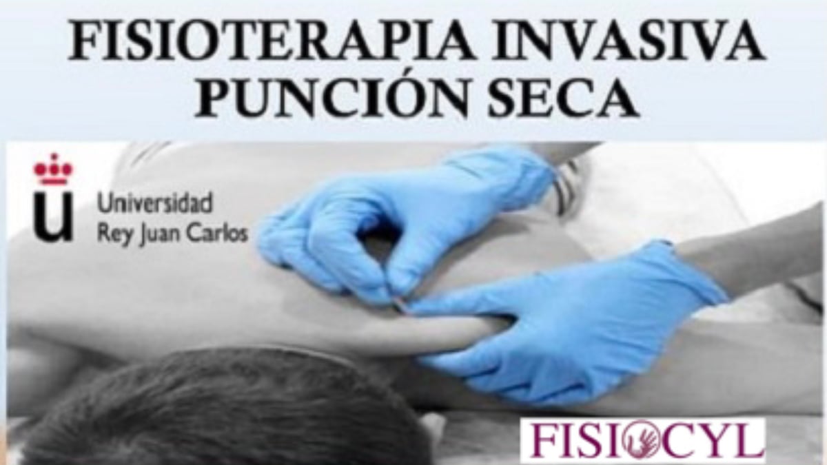 Fisioterapia invasiva: Puntos gatillo y punción seca en el dolor musculoesquelético Fisioterapia invasiva: Puntos gatillo y punción seca en el dolor musculoesquelético