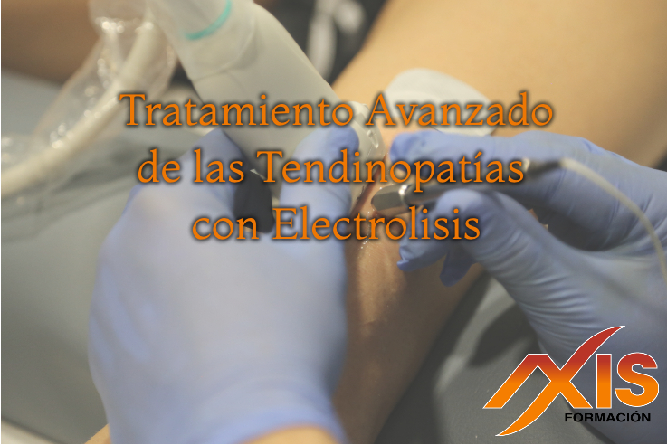 Curso de Electrolisis: Tratamiento Avanzado de las Tendinopatías con Electrolisis Curso de Electrolisis: Tratamiento Avanzado de las Tendinopatías con Electrolisis