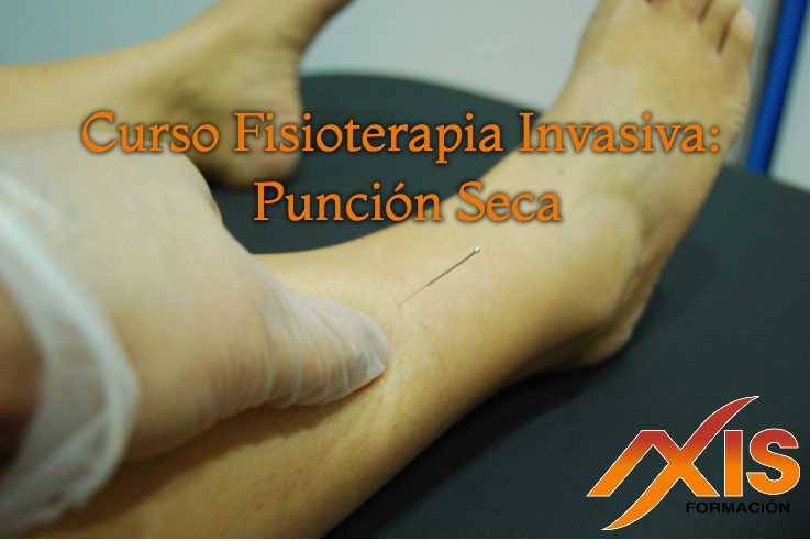 Curso de Fisioterapia Curso de Fisioterapia Invasiva: Punción Seca (Edición 38)