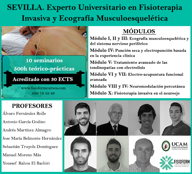 Experto universitario en fisioterapia invasiva y ecografía musculoesquelética (Sevilla) Fisioform-Ucam. 30 créditos ects