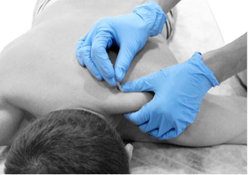 Fisioterapia invasiva: Puntos gatillo y punción seca en el dolor musculoesquelético