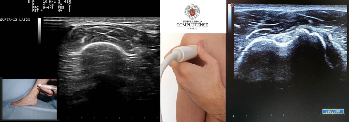 Experto en Ecografía, Anatomía Palpatoria e Investigación del Cuerpo Humano in Vivo y Técnica Invasiva en Cadáver - Universidad Complutense de Madrid (UCM) Experto en Ecografía, Anatomía Palpatoria e Investigación del Cuerpo Humano in Vivo y Técnica Invasiva en Cadáver - Universidad Complutense de Madrid (UCM)