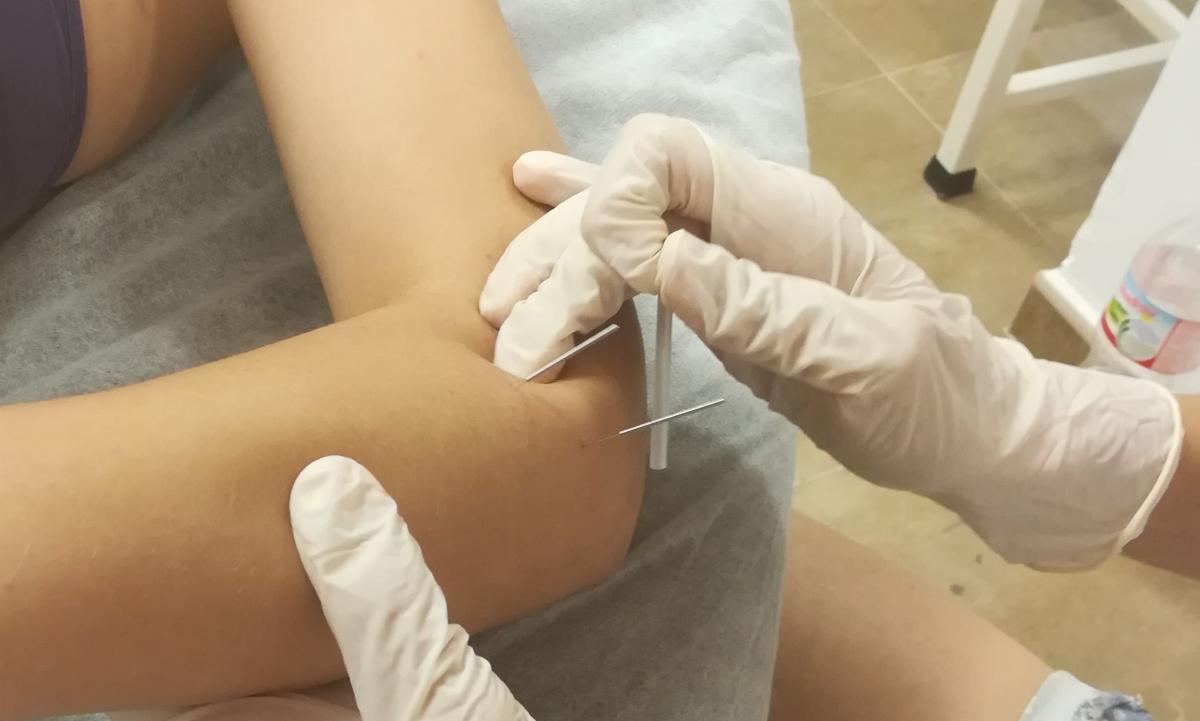 Postgrado de Fisioterapia Invasiva